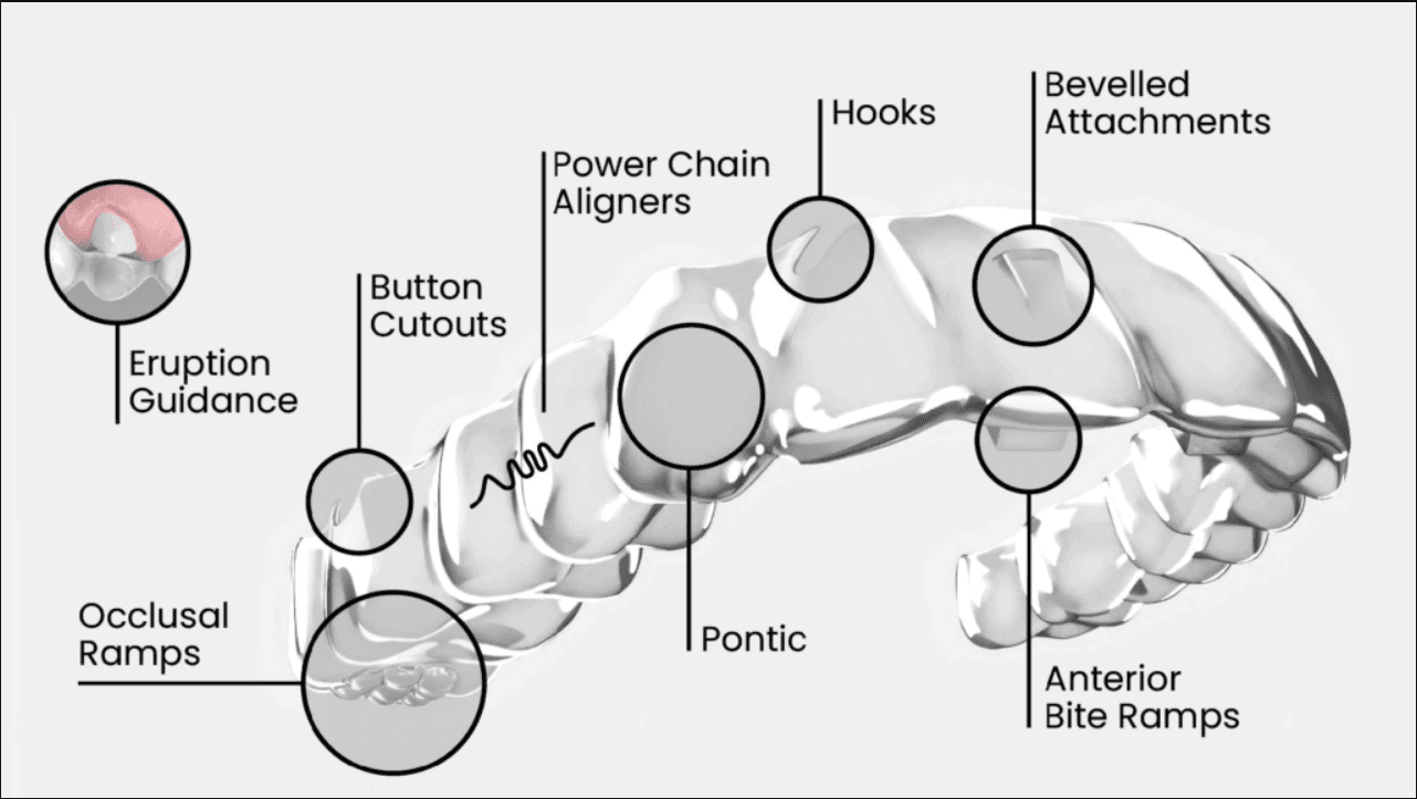 How to Handle Aligner Attachments, Buttons & Elastics: Patient Survival Guide