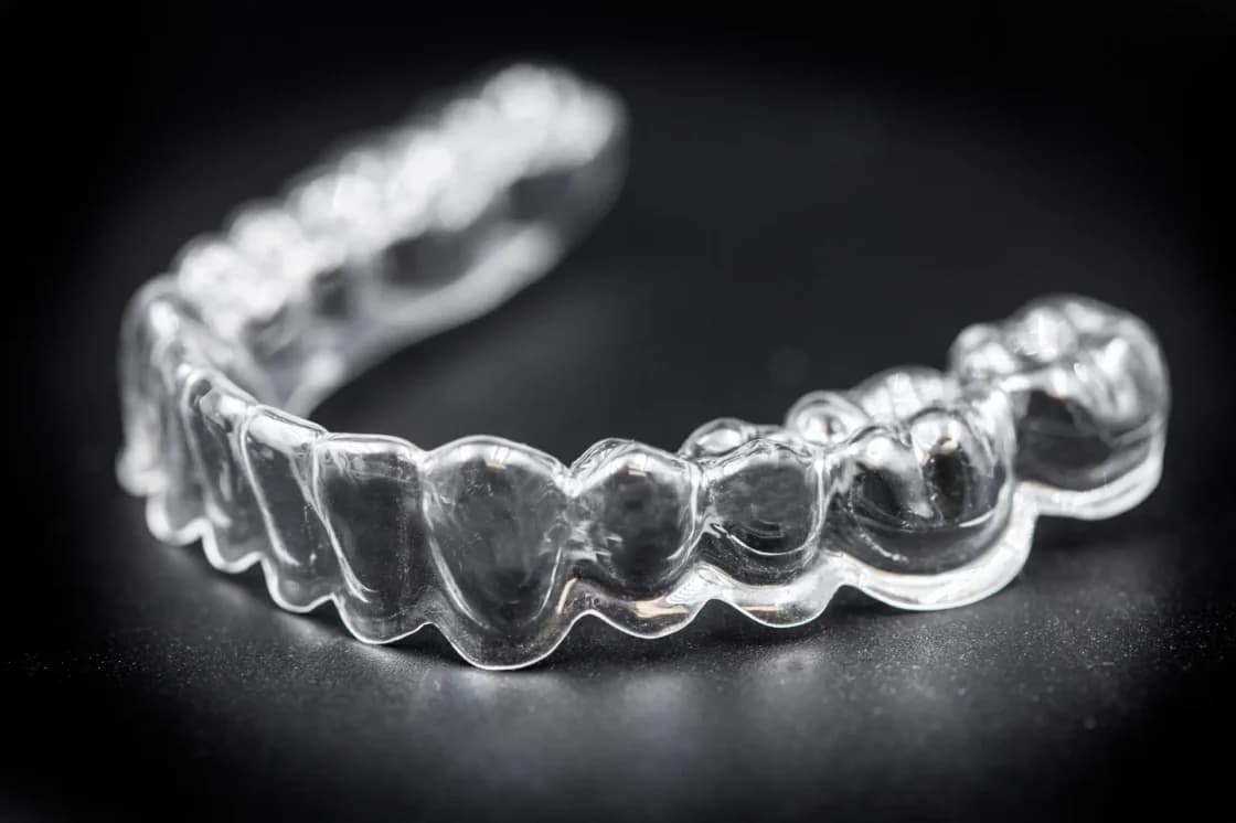 Are Clear Aligners Worth It? Cost Breakdown, Timeline & Long-Term Value Guide